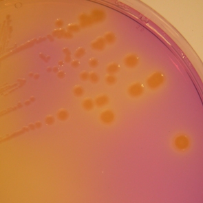 Bromocresol Purple L.Agar | Labema - Life Science and Biotechnology expert